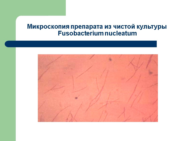 Микроскопия препарата из чистой культуры Fusobacterium nucleatum